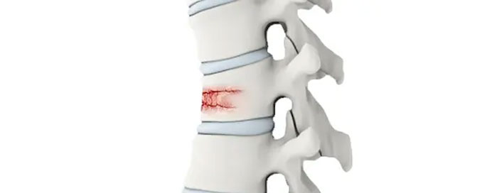 Specialist For Spine Injury in Andheri